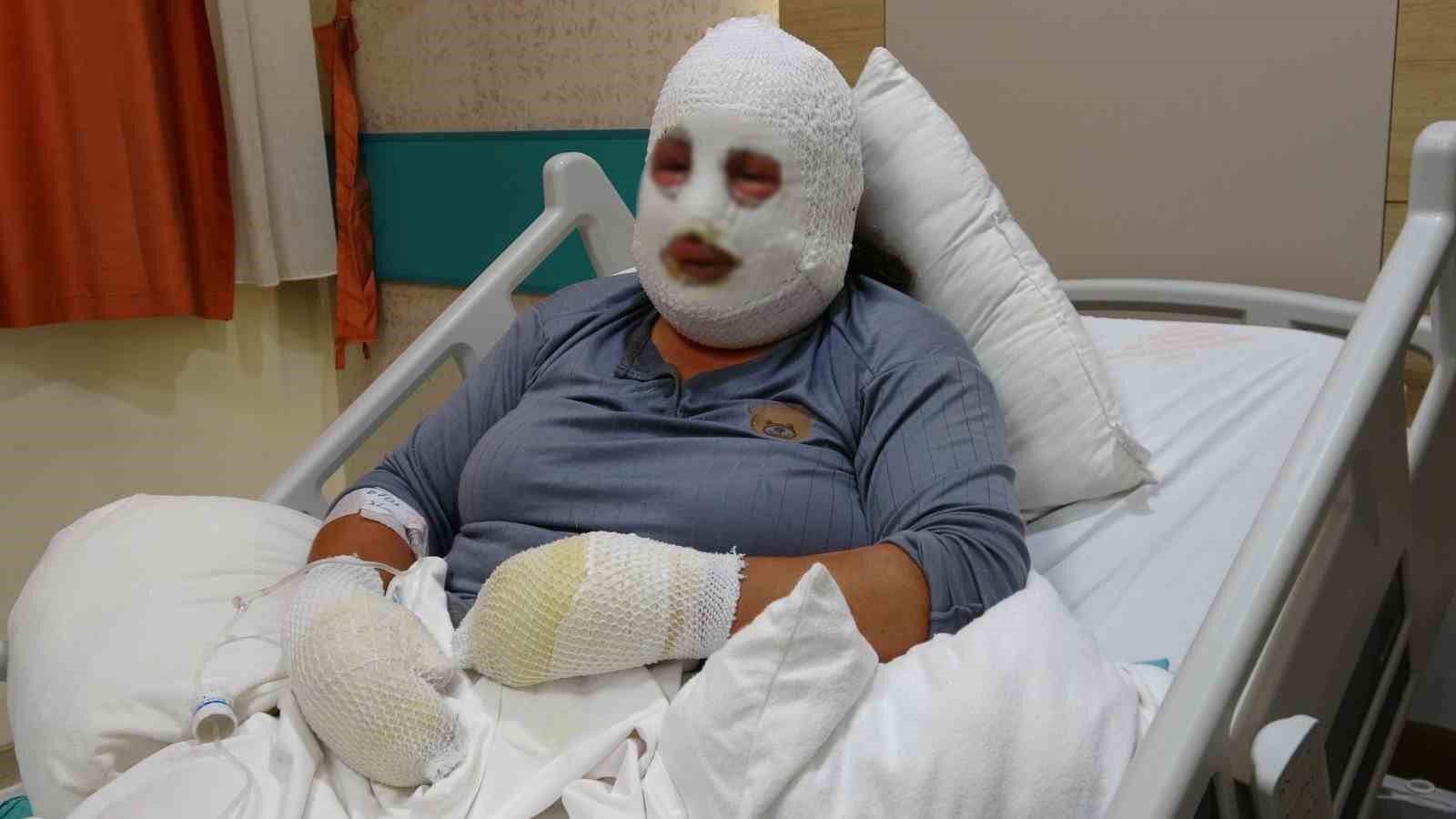 Ardahan’da yangın: Kızını kurtaran anne alevlerin arasında yaralandı
