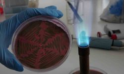 Çiğ süt, gıdayla bulaşan idrar yolu enfeksiyonlarına davetiye çıkarıyor