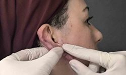 Ödüllü cerrahi yöntem Muş’ta ilk kez uygulandı