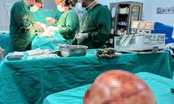 Van’da hastanın karnından dev kitle çıkarıldı