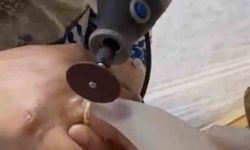 Kazada yaralanan kadının parmağına sıkışan yüzük için itfaiye seferber oldu