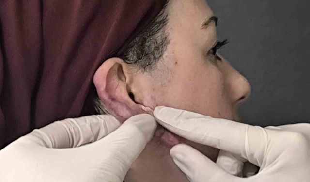 Ödüllü cerrahi yöntem Muş’ta ilk kez uygulandı