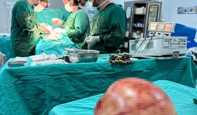 Van’da hastanın karnından dev kitle çıkarıldı