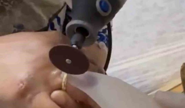 Kazada yaralanan kadının parmağına sıkışan yüzük için itfaiye seferber oldu