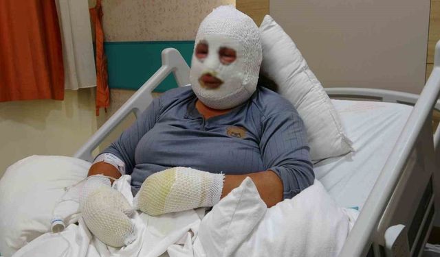 Ardahan’da yangın: Kızını kurtaran anne alevlerin arasında yaralandı